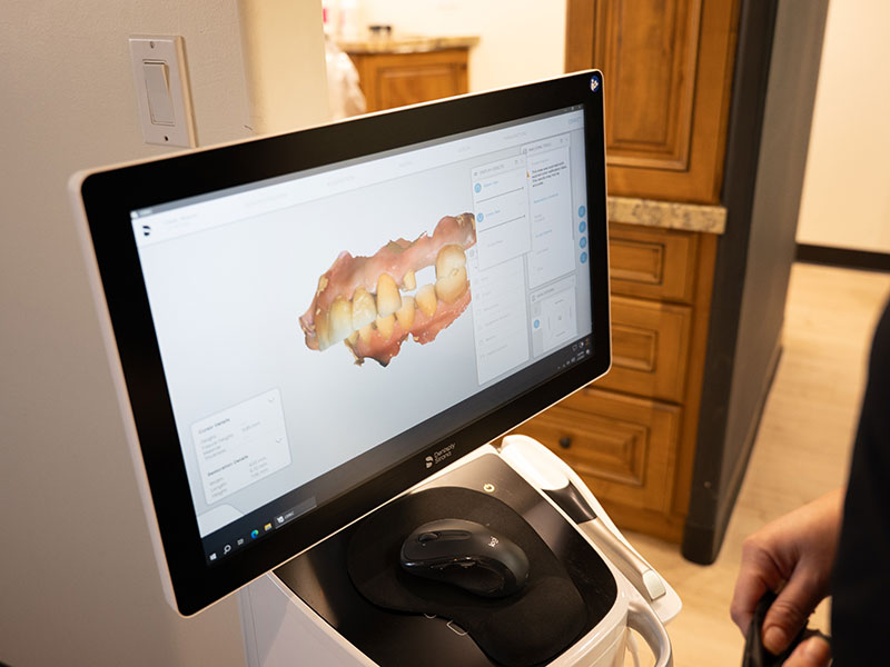 Same-day Emergency Dental Services in Mesa, AZ