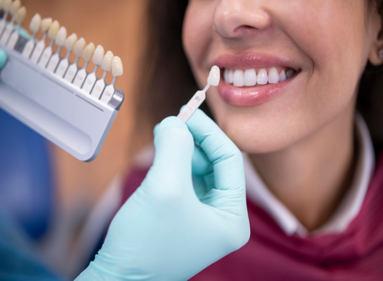 Dentist holding a tooth shade palette to match dental crown color in Mesa, AZ